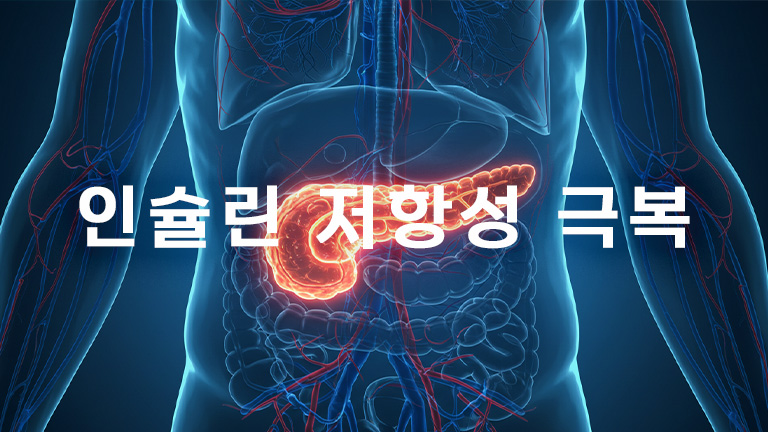 인슐린 저항성 극복: 다이어트 성공을 위한 핵심 호르몬 관리 전략