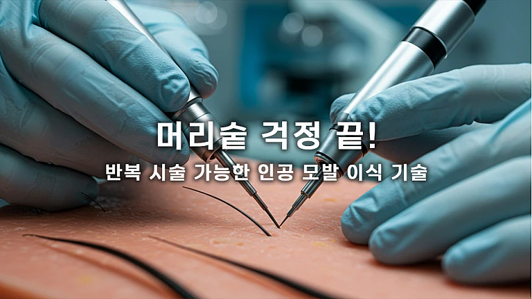 머리숱 걱정 끝! 반복 시술 가능한 인공 모발 이식 기술